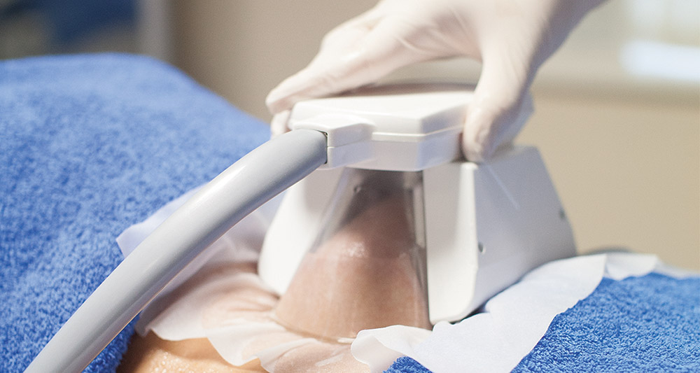 How Fat Freezing and HIFU Work Together? 2 Multiple Areas in One Session HIFU and Fat Freezing Wimborne