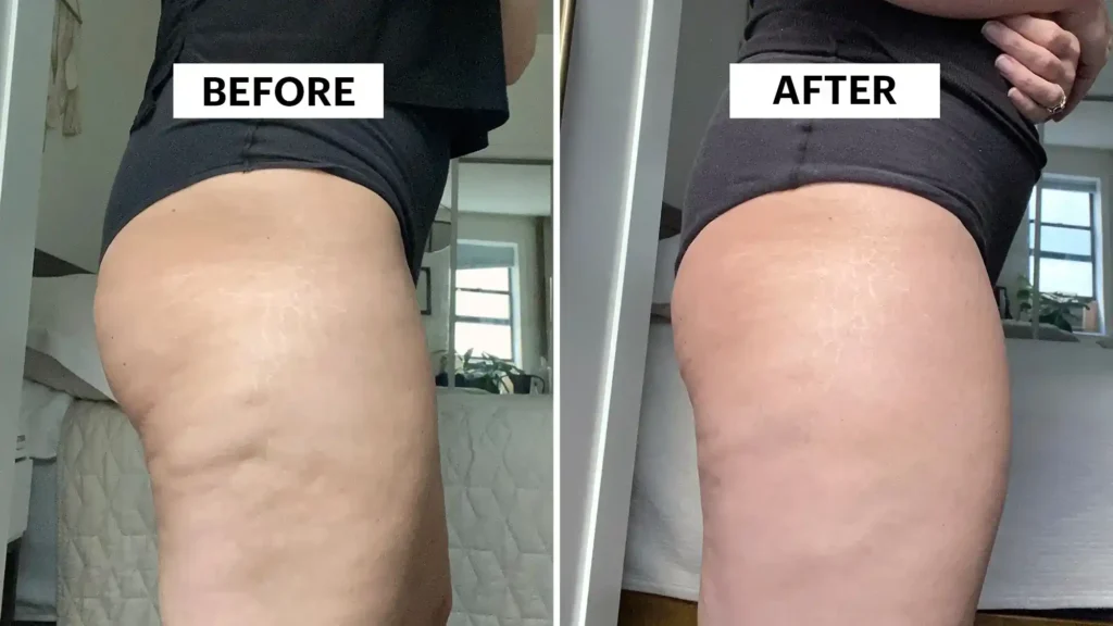Sculpting Your Bum: Can Toning Exercises Really Reduce Cellulite? 1 Do Toning Exercise Wimborne Really Tackle Cellulite?